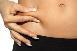 Liposuction by New York Plastic Surgeon Dr Nicholas Vendemia of MAS, liposuction nyc